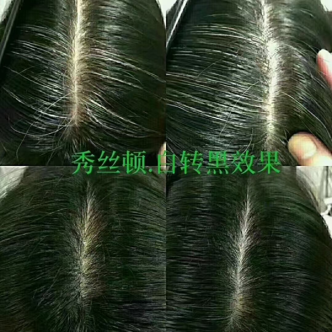 zDֲBl^