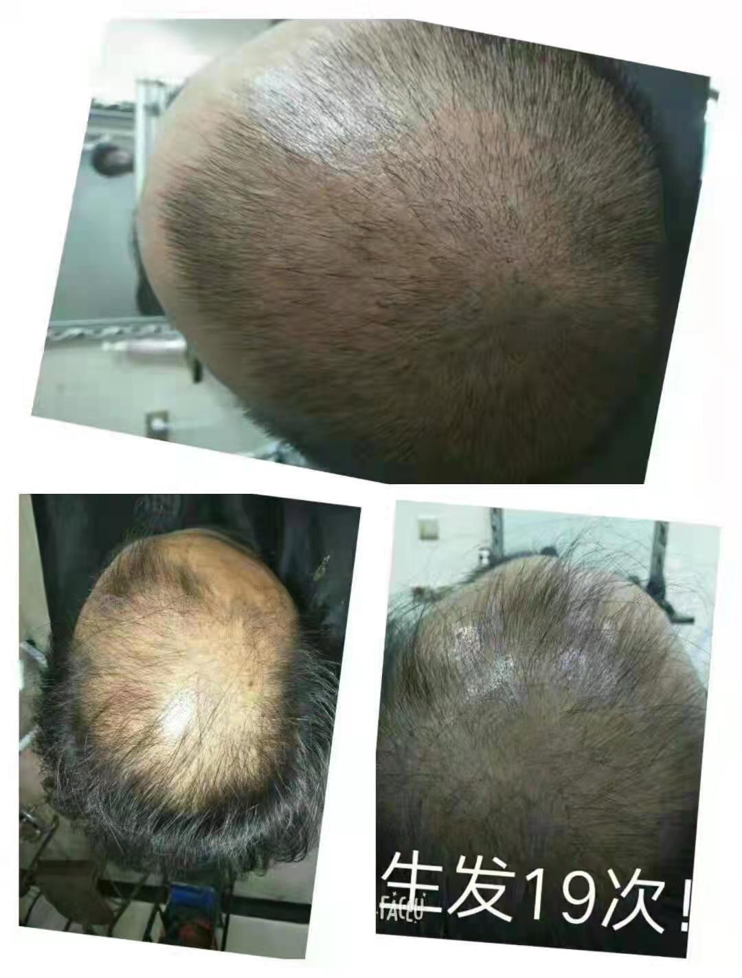 zDֲB(yng)l(f)üȻĲݱֲﾫAжN(du)^l(f)ĠI(yng)B(yng)ɷ
