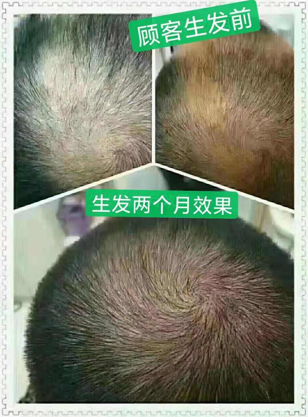 zDֲBl^вˎϴ^ƤͨëңȥƤ|˨ȥW