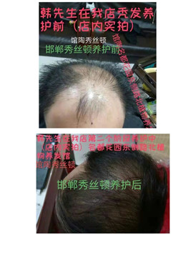 zDֲB(yng)l(f)һNȻ^l(f)o(h)a(chn)Ʒ