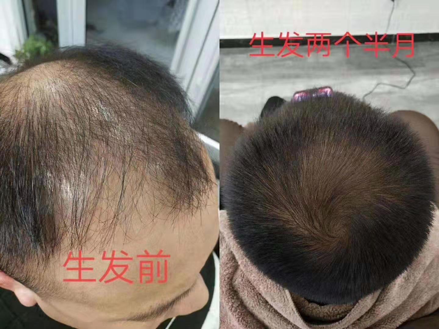 zDֲB(yng)l(f)Ól(f)a(chn)Ʒ㌢нܵ^l(f)