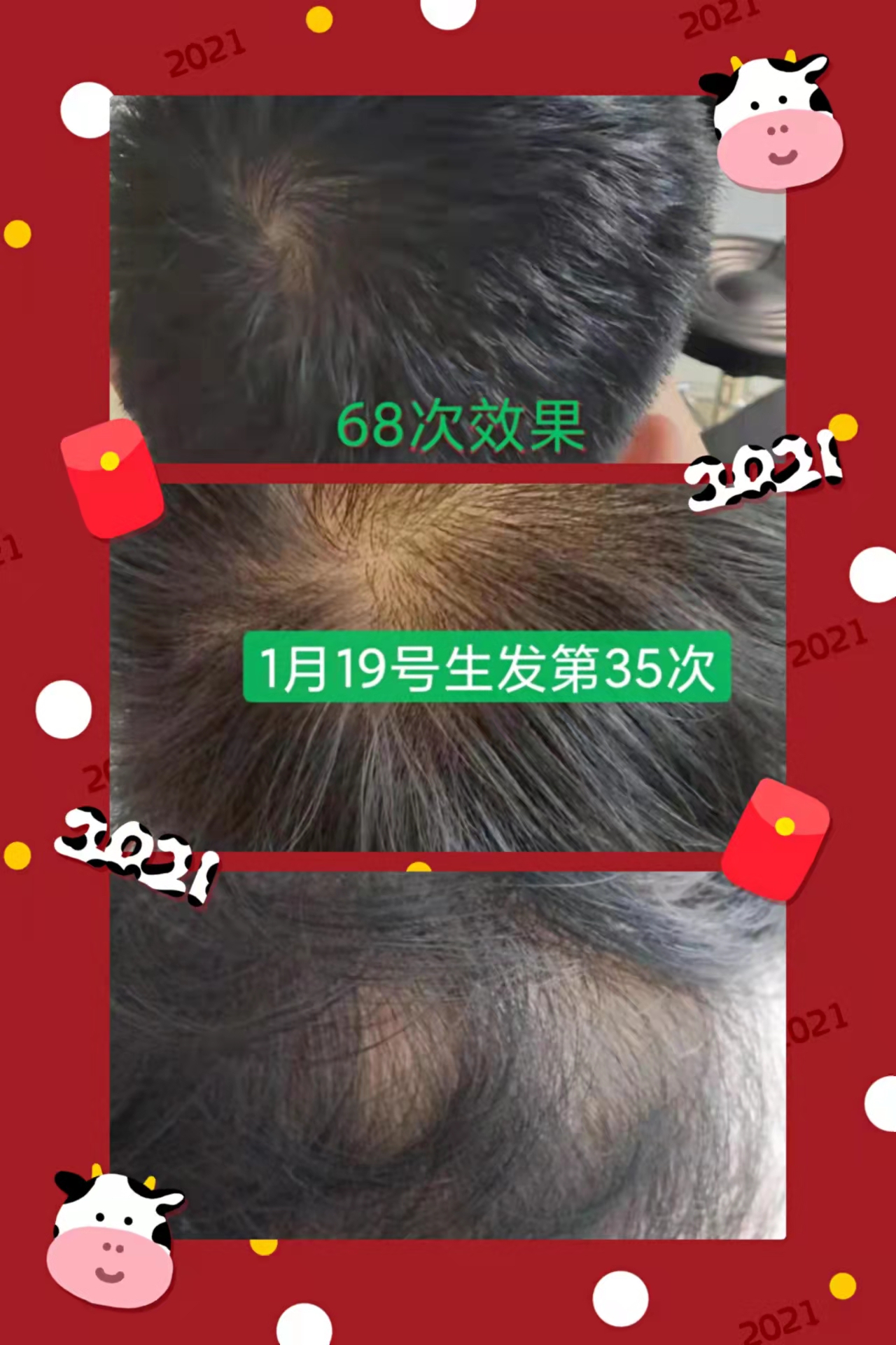 zDֲȾlüȻֲɷ֣κλWӄ^lo