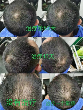 zDֲÓa(chn)ƷӰȫغ(hu)(du)^Ƥ^l(f)ɂ