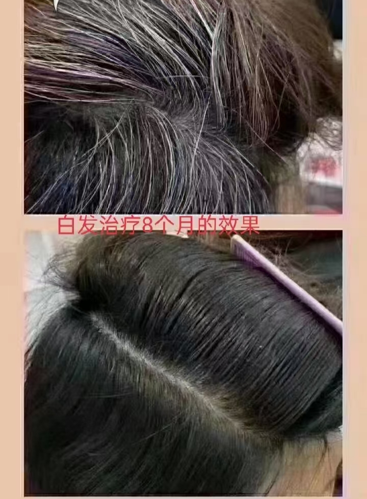 zDֲBl^ָT˂ṩBޏ^lĈ
