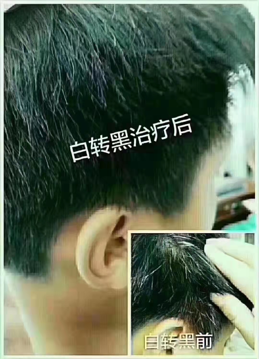 zDֲBlrПoΣ