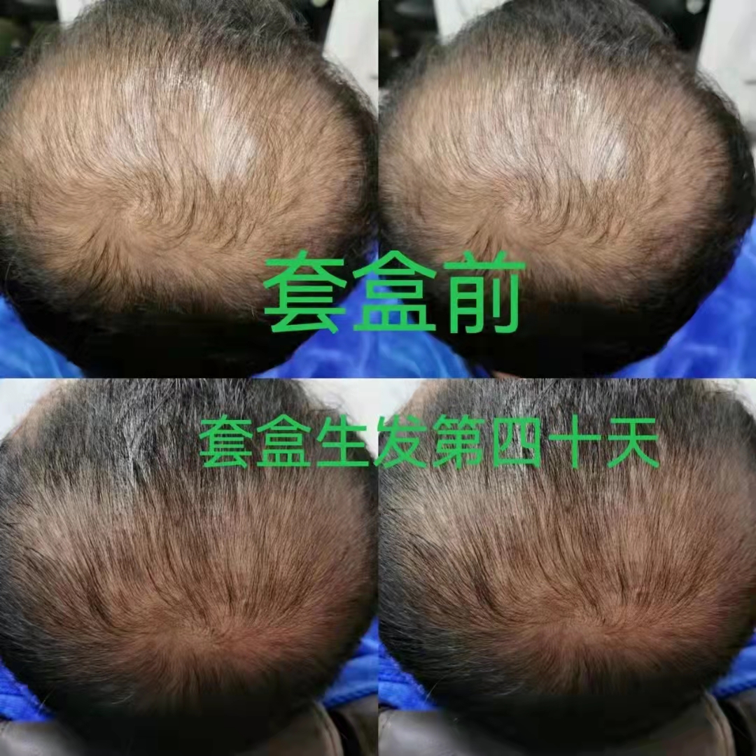 zDֲBlȻֲȡͨ^ƌWȣ^lṩȫĠIB^ƤM^lL
