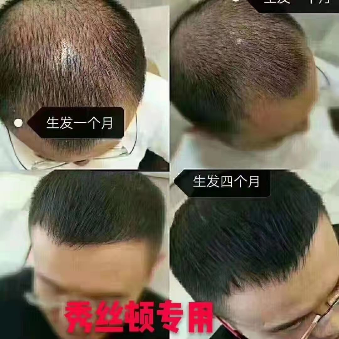 zDֲB(yng)l(f)ȻֲȡᘌN^l(f)}M(jn)ίÓl(f)װl(f)D(zhun)ڡ߶d