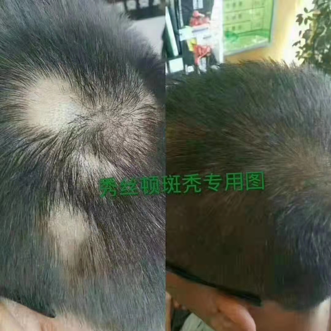 zDֲB(yng)l(f)r(sh)Пo(w)Σ