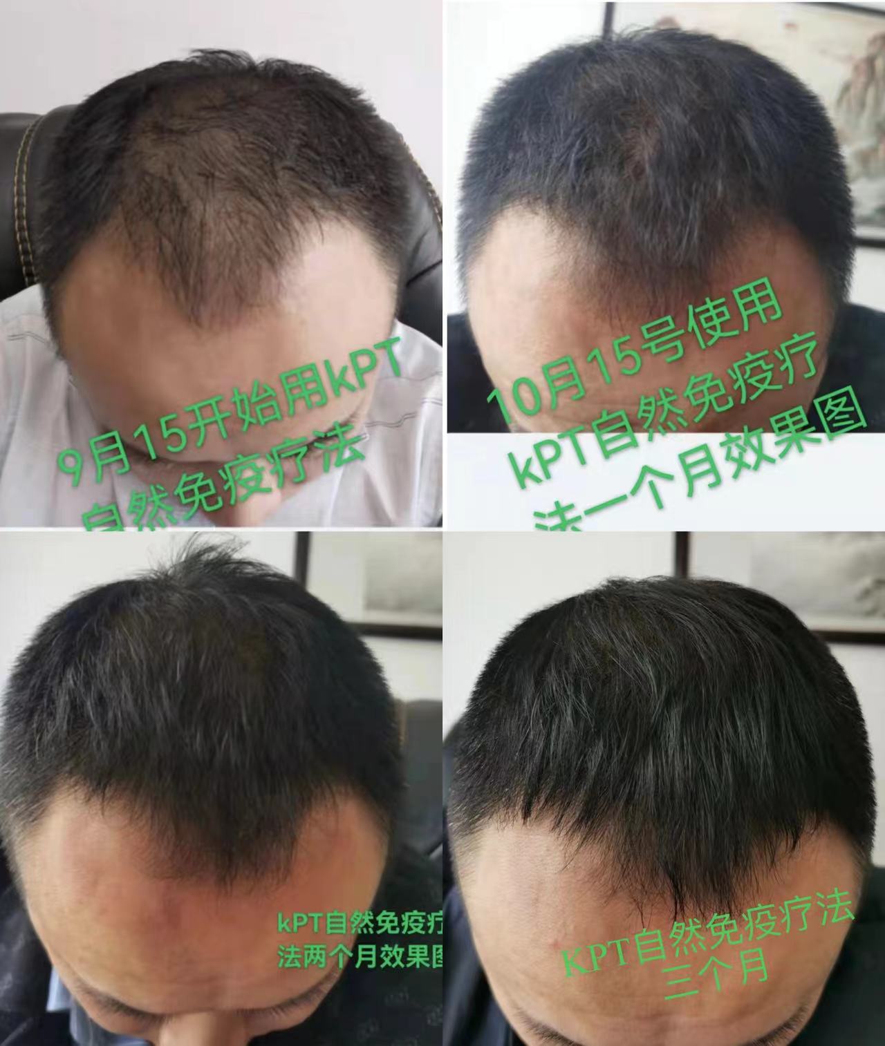 zDװl(f)ȻD(zhun)ڮa(chn)Ʒȫo(w)W(xu)ӣ׌^l(f)جF(xin)p