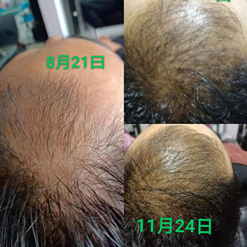 zDֲB(yng)l(f)r(sh)нȻš׌҂һo(h)h(hun)o(h)ԼxȻֲB(yng)l(f)